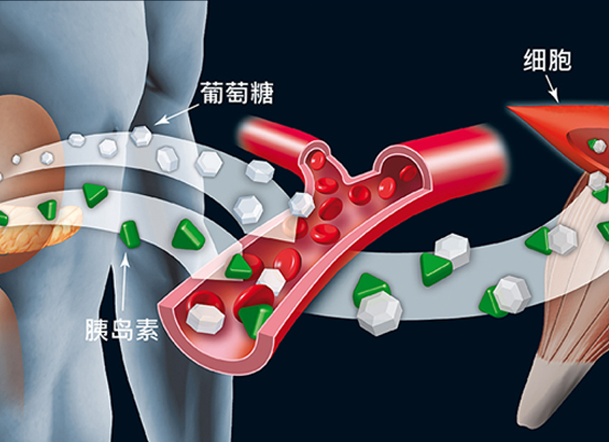 瑞特教你認(rèn)識糖尿病